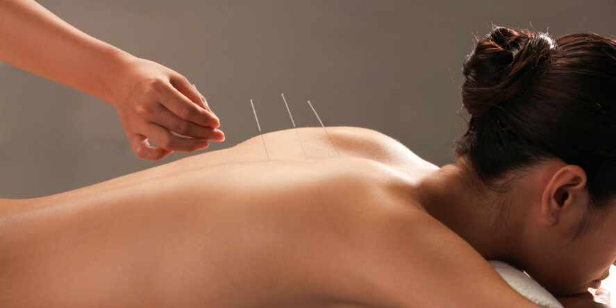 Acupuncture