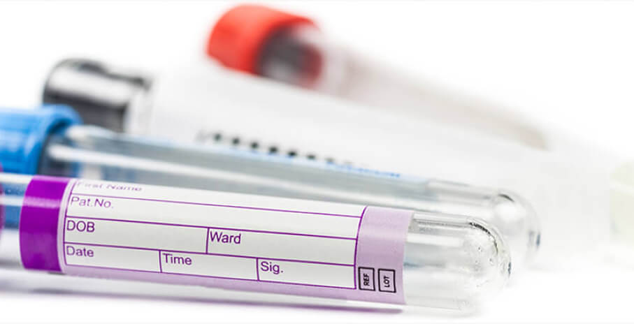 testing Hiv Better Know